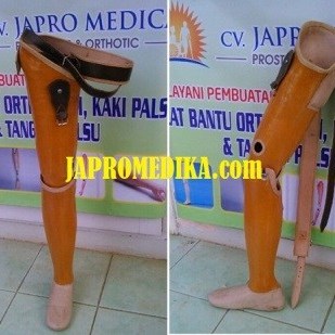 kaki_palsu_atas_lutut_konvensional1