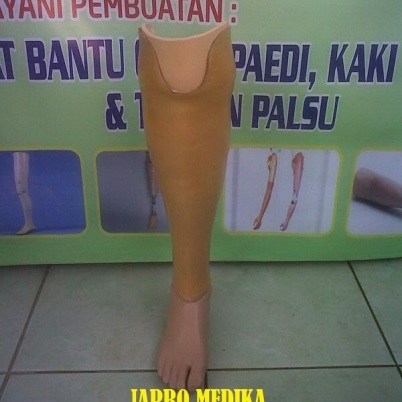 kaki_palsu_bawah_lutut_0