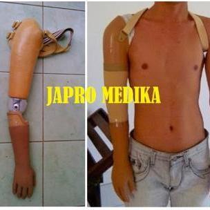 tangan_atas_siku