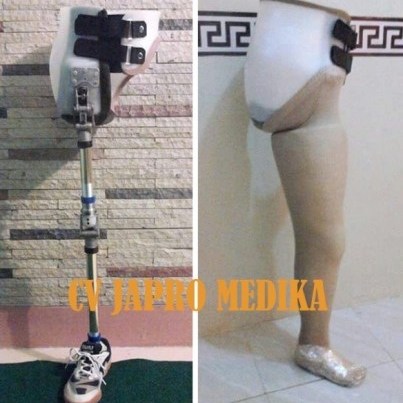 tepat-hip