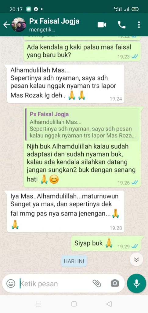 Testimoni pasien kaki palsu tangan palsu