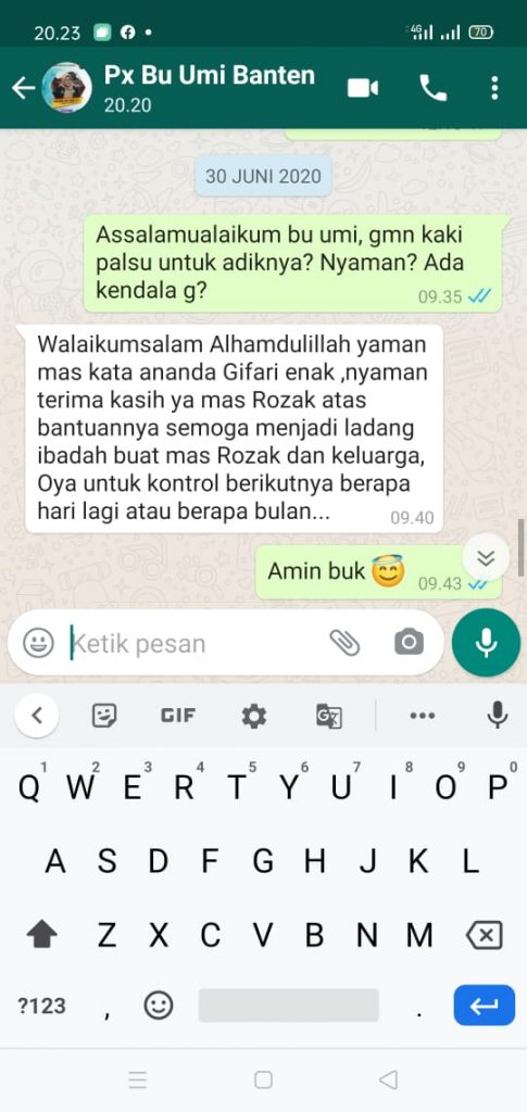 Testimoni pasien kaki palsu tangan palsu