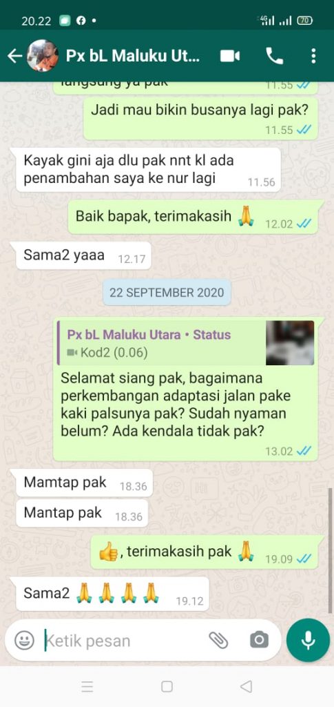 Testimoni pasien kaki palsu tangan palsu