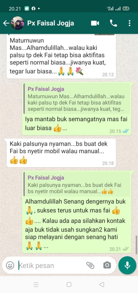 Testimoni pasien kaki palsu tangan palsu